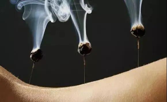 艾灸不是藥，調的不是病，央視為艾灸正名，讓我們正視艾灸