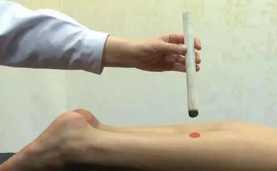 人體“消毒穴”每周艾灸4次，逼出陳年藥毒！