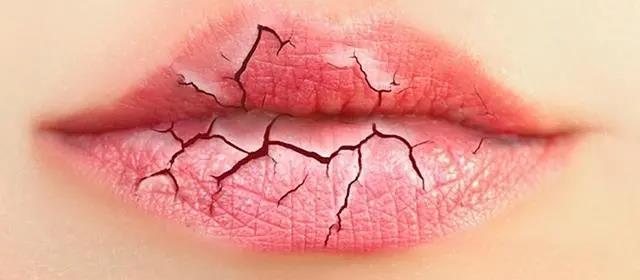 嘴唇干裂，或許不是缺水，嘴唇老是干艾灸什么穴位！