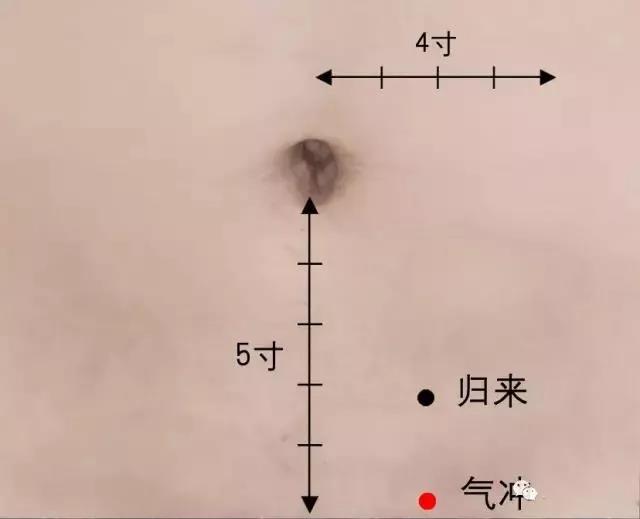 　一艾灸就上火，這是為什么?