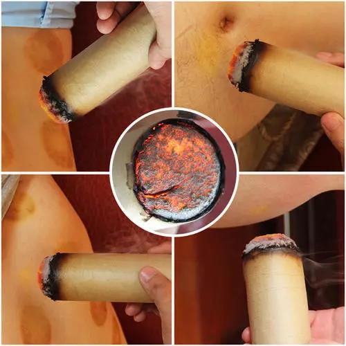 灸溫，到底是燙的好還是溫的好？為什么有的人感覺(jué)不到熱?