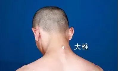 春天灸灸背，能活一百歲~