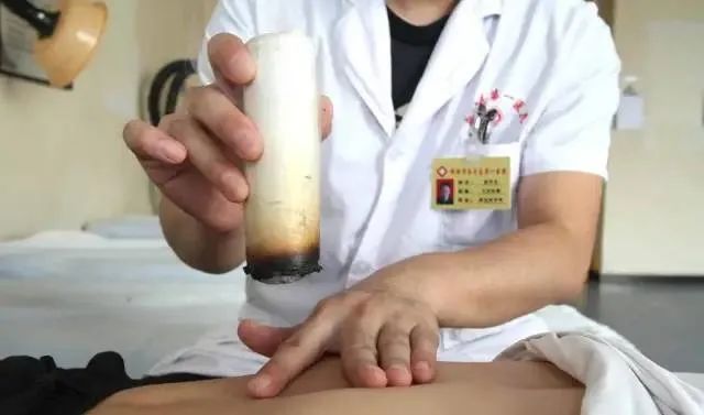 產(chǎn)后艾灸一個(gè)月，十年少生??！ 