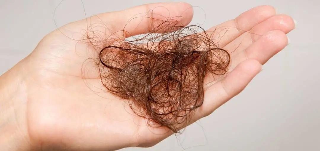 你脫的不是發(fā)，是氣血！艾灸拯救脫發(fā)危機！