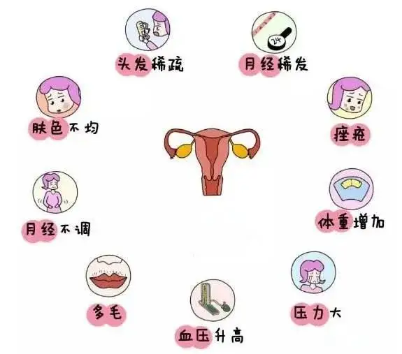 10個(gè)女人就有1個(gè)患多囊！被它纏上不要怕，艾灸幫你調“多囊”！